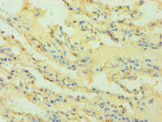 Immunohistochemistry of paraffin-embedded human lung tissue using CSB-PA010509ESR2HU at dilution of 1:100