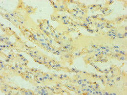 Immunohistochemistry of paraffin-embedded human lung tissue using CSB-PA010509ESR2HU at dilution of 1:100