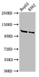 Western Blot Positive WB detected in: HepG2 whole cell lysate, K562 whole cell lysate All lanes: HLTF antibody at 3ug/ml Secondary Goat polyclonal to rabbit IgG at 1/50000 dilution Predicted band size: 114, 100 kDa Observed band size: 114 kDa