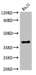 Western Blot Positive WB detected in: Raji whole cell lysate All lanes: HMBS antibody at 3µg/ml Secondary Goat polyclonal to rabbit IgG at 1/50000 dilution Predicted band size: 40, 38, 35, 34 kDa Observed band size: 40 kDa