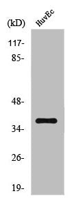Western Blot analysis of HuvEc cells using IκB-α Polyclonal Antibody