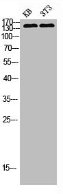 Western blot analysis of kb 3T3 lysis using PLC γ2 antibody.