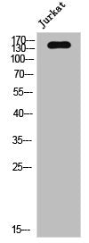 Western Blot analysis of Jurkat cells using CD45 Polyclonal Antibody
