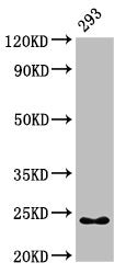 Western Blot Positive WB detected in: 293 whole cell lysate All lanes: HMGB3 antibody at 7µg/ml Secondary Goat polyclonal to rabbit IgG at 1/50000 dilution Predicted band size: 23 kDa Observed band size: 23 kDa