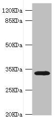 Western blot All lanes: HMGCL antibody at 0.8ug/ml + Rat liver tissue Secondary Goat polyclonal to rabbit IgG at 1/10000 dilution Predicted band size: 35, 27, 21 kDa Observed band size: 35 kDa