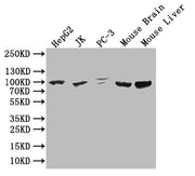 Western Blot Positive WB detected in: HepG2 whole cell lysate, JK whole cell lysate,PC-3 whole cell lysate, Mouse Brain tissue lysate, Mouse Liver tissue lysate All lanes: HMGCR antibody at 1:1000 Secondary Goat polyclonal to rabbit IgG at 1/50000...