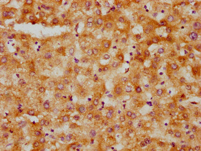 IHC image of CSB-PA010566LA01HU diluted at 1:500 and staining in paraffin-embedded human liver tissue performed on a Leica BondTM system. After dewaxing and hydration, antigen retrieval was mediated by high pressure in a citrate buffer (pH 6.0). S...