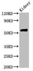 Western Blot Positive WB detected in: Rat kidney tissue All lanes: HMGCS2 antibody at 4.5ug/ml Secondary Goat polyclonal to rabbit IgG at 1/50000 dilution Predicted band size: 57, 53, 51 kDa Observed band size: 57 kDa