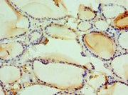 Immunohistochemistry of paraffin-embedded human thyroid tissue using CSB-PA010570ESR2HU at dilution of 1:100