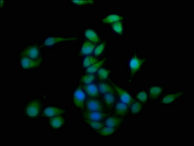Immunofluorescence staining of Hela cells with CSB-PA010584HA01HU at 1:100, counter-stained with DAPI. The cells were fixed in 4% formaldehyde, permeabilized using 0.2% Triton X-100 and blocked in 10% normal Goat Serum. The cells were then incubat...