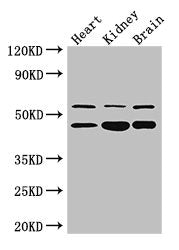 Western Blot Positive WB detected in: Mouse heart tissue, , Mouse kidney tissue, Mouse brain tissue All lanes: HNF4A antibody at 3ug/ml Secondary Goat polyclonal to rabbit IgG at 1/50000 dilution Predicted band size: 53, 52, 47, 57, 51, 49, 44 kDa...