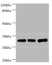 Western blot All lanes: HNRNPA0 antibody at 12ug/ml Lane 1: Mouse brain tissue Lane 2: Hela whole cell lysate Lane 3: Jurkat whole cell lysate Secondary Goat polyclonal to rabbit IgG at 1/10000 dilution Predicted band size: 31 kDa Observed band si...