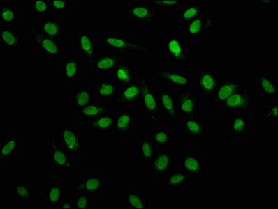 Immunofluorescence staining of Hela cells with CSB-PA010600HA01HU at 1:100, counter-stained with DAPI. The cells were fixed in 4% formaldehyde, permeabilized using 0.2% Triton X-100 and blocked in 10% normal Goat Serum. The cells were then incubat...