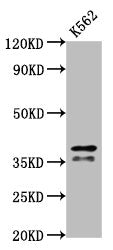 Western Blot Positive WB detected in: K562 whole cell lysate All lanes: HNRNPAB antibody at 2.7µg/ml Secondary Goat polyclonal to rabbit IgG at 1/50000 dilution Predicted band size: 37, 36, 31 kDa Observed band size: 37, 36 kDa