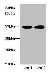Western blot All lanes: HNRNPH1 antibody at 8µg/ml Lane 1: HepG2 whole cell lysate Lane 2: MCF-7 whole cell lysate Secondary Goat polyclonal to rabbit IgG at 1/10000 dilution Predicted band size: 50 kDa Observed band size: 50 kDa