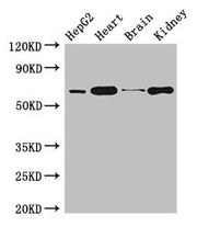 Western Blot Positive WB detected in: HepG2 whole cell lysate, Mouse heart tissue, Mouse brain tissue, Mouse kidney tissue All lanes: HNRNPL antibody at 3µg/ml Secondary Goat polyclonal to rabbit IgG at 1/50000 dilution Predicted band size: 65, 51...