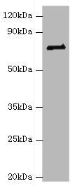 Western blot All lanes: HNRNPM antibody at 2ug/ml + NIH/3T3 whole cell lysate Secondary Goat polyclonal to rabbit IgG at 1/10000 dilution Predicted band size: 78, 74 kDa Observed band size: 78 kDa