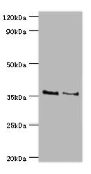 Western blot All lanes: HOXA1 antibody at 2ug/ml Lane 1: NIH/3T3 whole cell lysate Lane 2: Hela whole cell lysate Secondary Goat polyclonal to rabbit IgG at 1/10000 dilution Predicted band size: 37, 15, 25 kDa Observed band size: 37 kDa
