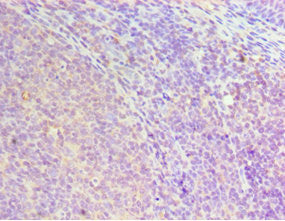 Immunohistochemistry of paraffin-embedded human tonsil tissue using CSB-PA010647DSR2HU at dilution of 1:100