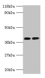 Western blot All lanes: ANXA2 antibody at 2µg/ml Lane 1: 293T whole cell lysate Lane 2: EC109 whole cell lysate Secondary Goat polyclonal to rabbit IgG at 1/15000 dilution Predicted band size: 39, 41 kDa Observed band size: 39 kDa
