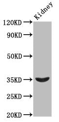 Western Blot Positive WB detected in: Rat kidney tissue All lanes: HOXA4 antibody at 2.3ug/ml Secondary Goat polyclonal to rabbit IgG at 1/50000 dilution Predicted band size: 35 kDa Observed band size: 35 kDa