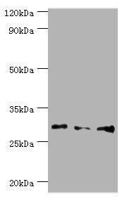 Western blot All lanes: Homeobox protein Hox-B5 antibody at 8ug/ml Lane 1: HepG2 whole cell lysate Lane 2: Rat liver tissue Lane 3: Rat lung tissue Secondary Goat polyclonal to rabbit IgG at 1/10000 dilution Predicted band size: 29 kDa Observed ba...