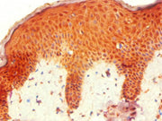Immunohistochemistry of paraffin-embedded human skin tissue using CSB-PA010667ESR1HU at dilution of 1:100
