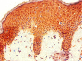 Immunohistochemistry of paraffin-embedded human skin tissue using CSB-PA010667ESR1HU at dilution of 1:100
