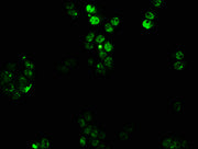 Immunofluorescence staining of PC3 cells with CSB-PA010677LA01HU at 1:100, counter-stained with DAPI. The cells were fixed in 4% formaldehyde, permeabilized using 0.2% Triton X-100 and blocked in 10% normal Goat Serum. The cells were then incubate...