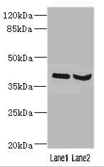 Western blot All lanes: HOXD10 antibody at 3.21ug/ml Lane 1: Mouse liver tissue Lane 2: Mouse gonadal tissue Secondary Goat polyclonal to rabbit IgG at 1/10000 dilution Predicted band size: 38 kDa Observed band size: 38 kDa