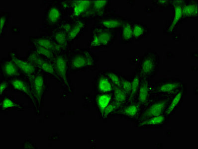 Immunofluorescent analysis of Hela cells using CSB-PA010684LA01HU at dilution of 1:100 and Alexa Fluor 488-congugated AffiniPure Goat Anti-Rabbit IgG(H+L)