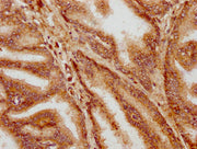 IHC image of CSB-PA010685LA01HU diluted at 1:400 and staining in paraffin-embedded human prostate tissue performed on a Leica BondTM system. After dewaxing and hydration, antigen retrieval was mediated by high pressure in a citrate buffer (pH 6.0)...