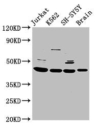 Western Blot Positive WB detected in: Jurkat whole cell lysate, K562 whole cell lysate, SH-SY5Y whole cell lysate, Rat brain tissue All lanes: HOXD3 antibody at 8.5ug/ml Secondary Goat polyclonal to rabbit IgG at 1/50000 dilution Predicted band si...