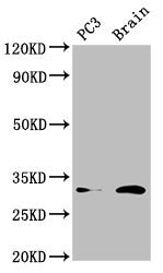 Western Blot Positive WB detected in: PC-3 whole cell lysate, Mouse brain tissue All lanes: HOXD8 antibody at 4.5µg/ml Secondary Goat polyclonal to rabbit IgG at 1/50000 dilution Predicted band size: 32, 9 kDa Observed band size: 32 kDa