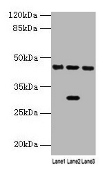 Western blot All lanes: HPD antibody at 4.5µg/ml Lane 1: Mouse kidney tissue Lane 2: Mouse liver tissue Lane 3: HepG2 whole cell lysate Secondary Goat polyclonal to rabbit IgG at 1/10000 dilution Predicted band size: 45, 41 kDa Observed band size:...