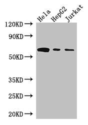Western Blot Positive WB detected in: Hela whole cell lysate, HepG2 whole cell lysate, Jurkat whole cell lysate All lanes: HPSE antibody at 3ug/ml Secondary Goat polyclonal to rabbit IgG at 1/50000 dilution Predicted band size: 62, 55, 54, 43 kDa...