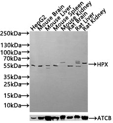 Western blot All lanes: Hpx antibody at 4.5µg/ml + HepG2 whole cell lysate Secondary Goat polyclonal to rabbit IgG at 1/10000 dilution Predicted band size: 52 kDa Observed band size: 52 kDa