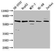 Western Blot Positive WB detected in: SH-SY5Y whole cell lysate, HepG2 whole cell lysate, MCF-7 whole cell lysate, HL-60 whole cell lysate, Jurkat whole cell lysate All lanes: HRG antibody at 4.6µg/ml Secondary Goat polyclonal to rabbit IgG at 1/5...