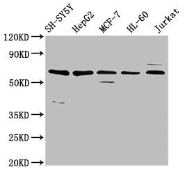 Western Blot Positive WB detected in: SH-SY5Y whole cell lysate, HepG2 whole cell lysate, MCF-7 whole cell lysate, HL-60 whole cell lysate, Jurkat whole cell lysate All lanes: HRG antibody at 4.6µg/ml Secondary Goat polyclonal to rabbit IgG at 1/5...