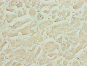 Immunohistochemistry of paraffin-embedded human heart tissue using CSB-PA010747LA01HU at dilution of 1:100