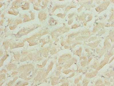 Immunohistochemistry of paraffin-embedded human heart tissue using CSB-PA010747LA01HU at dilution of 1:100