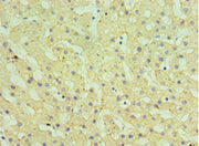 Immunohistochemistry of paraffin-embedded human liver tissue using CSB-PA010763ESR1HU at dilution of 1:100