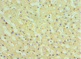 Immunohistochemistry of paraffin-embedded human liver tissue using CSB-PA010763ESR1HU at dilution of 1:100