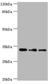 Western blot All lanes: Corticosteroid 11-beta-dehydrogenase isozyme 1 antibody at 7ug/ml Lane 1: Mouse liver tissue Lane 2: Jurkat whole cell lysate Lane 3: LO2 whole cell lysate Secondary Goat polyclonal to rabbit IgG at 1/10000 dilution Predict...