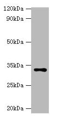 Western blot All lanes: HSD11B1 antibody at 2µg/ml + Hela whole cell lysate Secondary Goat polyclonal to rabbit IgG at 1/10000 dilution Predicted band size: 33 kDa Observed band size: 33 kDa