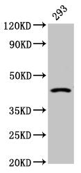 Western Blot Positive WB detected in: 293 whole cell lysate All lanes: HSD11B2 antibody at 2.4µg/ml Secondary Goat polyclonal to rabbit IgG at 1/50000 dilution Predicted band size: 45 kDa Observed band size: 45 kDa