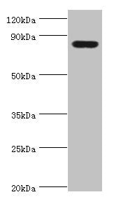 Western blot All lanes: Peroxisomal multifunctional enzyme type 2 antibody at 3ug/ml + Mouse liver tissue Secondary Goat polyclonal to rabbit IgG at 1/10000 dilution Predicted band size: 80, 84, 78 kDa Observed band size: 80 kDa