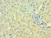 Immunohistochemistry of paraffin-embedded human liver tissue using CSB-PA010774ESR2HU at dilution of 1:100