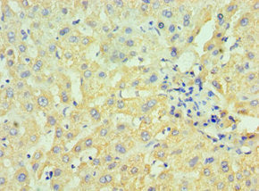 Immunohistochemistry of paraffin-embedded human liver tissue using CSB-PA010774ESR2HU at dilution of 1:100
