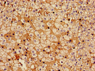 Immunohistochemistry of paraffin-embedded human adrenal gland tissue using CSB-PA010776LA01HU at dilution of 1:100